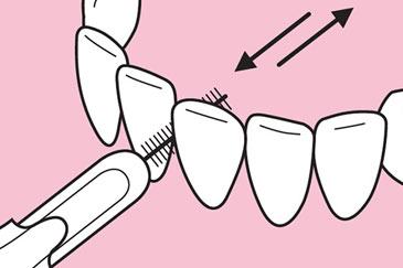 Nutzung Interdentalbürste